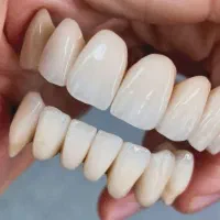 اموزش پروتزهای دندانی(ثابت)
