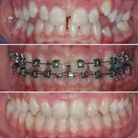 دندانپزشکی گران نیست، غفلت گران است(نقد اقساط)|خدمات آرایشگری و زیبایی|شیراز, گلدشت معالی‌آباد|دیوار