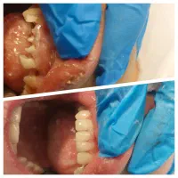 خدمات درمانی و زیبایی دندان|خدمات آرایشگری و زیبایی|کرمانشاه, |دیوار