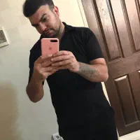 کاشت مو به جدید ترین روش