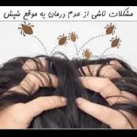 شامپوی ضد شپش و حتی پوچ کننده تخم شپش تضمینی|آرایشی، بهداشتی، درمانی|خرمدره, |دیوار