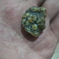 زوعه مار کبرا