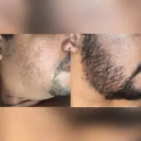ارگانیک و تضمینی درمان شو.