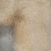 درمان مشکلات پوستی تخصصی|آرایشی، بهداشتی، درمانی|ارومیه, |دیوار