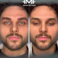 کیلینیک زیبایی