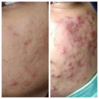 استخدام دستیار پزشک