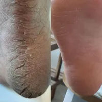 خدمات اسپا و پدیکور|خدمات آرایشگری و زیبایی|شیراز, شهرک ایثار|دیوار