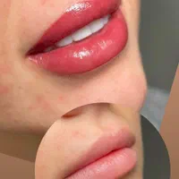 آرایش دائم صورت
