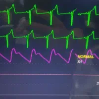 تعمیرات انواع تجهیزات پزشکی