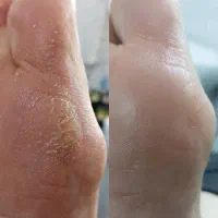 پدیکور و کفسابی پا|خدمات آرایشگری و زیبایی|قم, صدوق|دیوار