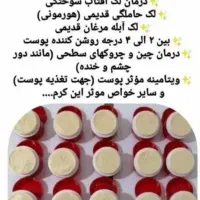 کرم معجزه اصل با گارانتی مرجوعی|آرایشی، بهداشتی، درمانی|سرپل ذهاب, |دیوار