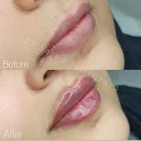 خدمات زیبایی دکتر سجاد جلیلی فرد|خدمات آرایشگری و زیبایی|مسجد سلیمان, |دیوار