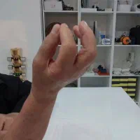 کاردرمانی تخصصی دست و سکته و ام اس|خدمات زیبایی و سلامت|مشهد, هفت تیر (حافظ)|دیوار