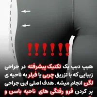 تخفیفات روزمادر تزریق ژل بوتاکس،مزوتراپی،فیلر بادی|خدمات آرایشگری و زیبایی|قم, باسکول|دیوار