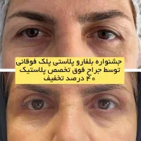 انجام عمل جراحی توسط فوق تخصص جراحی پلاستیک|خدمات آرایشگری و زیبایی|تهران, بلوار کشاورز|دیوار