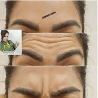 تزریق ژل و بوتاکس و آموزش حرفه ای|خدمات آرایشگری و زیبایی|اهواز, سپیدار|دیوار