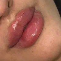آموزش و خدمات ژل و بوتاکس هر سیسی 590در مطب تخصصی|خدمات آرایشگری و زیبایی|اصفهان, رکن الدوله شرقی|دیوار