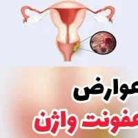 عفونت زنان
