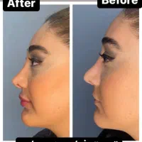 آموزش و خدمات ژل و بوتاکس|خدمات آرایشگری و زیبایی|زابل, |دیوار