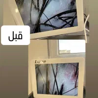 اسکراب اسکالپ(پاکسازی و درمان پوست سر)|خدمات آرایشگری و زیبایی|کرج, مطهری|دیوار