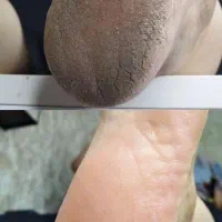 آموزش صفرتاصدناخن وپدیکور