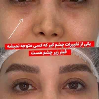 تزریق ژل فیلر مزوژل جوانساز بوتاکس لب روسی مزو مو|خدمات آرایشگری و زیبایی|کرج, گلشهر|دیوار
