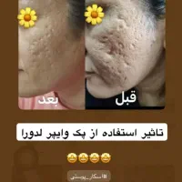 جوانسازی|آرایشی، بهداشتی، درمانی|شیراز, ابیوردی|دیوار