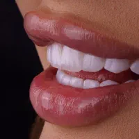 ساکشن تزریق کاشت مواندولیفت صورت