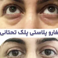 جشنواره خدمات زیبایی در اصفهان|خدمات آرایشگری و زیبایی|اصفهان, ملک|دیوار