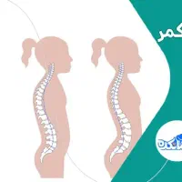 راهنمایی گودی کمر