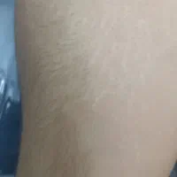 اپیلاسیون بانوان|خدمات آرایشگری و زیبایی|بیرجند, |دیوار