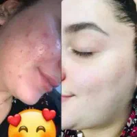 پوستی‌‌سفید‌وبدون‌لک