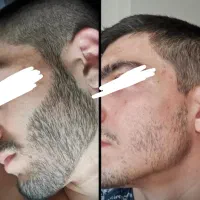 با ریش باش