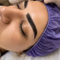 کاشت ابرو و مو  بلفاروپلاسی ساکشن غبغب و..