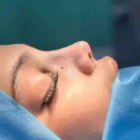 عمل بینی در بیمارستان ۴۵ تومن و کلینیک ۳۰ تومن|خدمات زیبایی و سلامت|اهواز, کیانپارس |دیوار