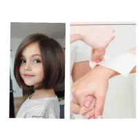 کوتاهی مو واپلاسیون