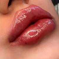 ژل لب۴۵۰ بوتاکس نخ فیلربینی زیرچشم آنزیم توسطپزشک