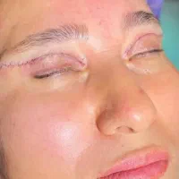 عمل زیبایی بینی|خدمات آرایشگری و زیبایی|حمیدیه, |دیوار