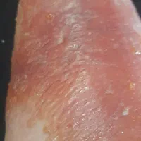 بهترین جراح و کارشناس زخم ایران|خدمات آرایشگری و زیبایی|تهران, جهاد|دیوار