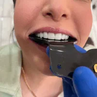 کامپوزیت دندانی اصولی