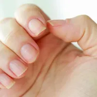 ریمو ناخن مرده|خدمات آرایشگری و زیبایی|اصفهان, کشاورزی|دیوار