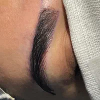 کاشت ابرو