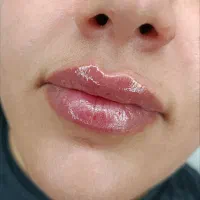 خدمات ژل فقط ۵۸۰ وبوتاکس ۷۵۰ در مطب|خدمات آرایشگری و زیبایی|نجف‌آباد, حومه نجف آباد|دیوار