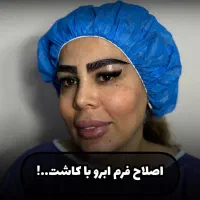 کاشت ابرو وموcip دربیمارستان جشنواره عید ۱۲ تومن