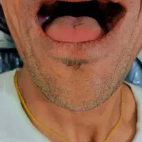 دندان سازی مروارید۳۰٪ اف|خدمات آرایشگری و زیبایی|بهبهان, |دیوار