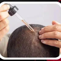 اکسیر گیاهی رویش مو|آرایشی، بهداشتی، درمانی|لاهیجان, کاروانسرابر|دیوار