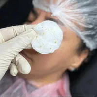 فیشال تخصصی و درمانی صورت|خدمات آرایشگری و زیبایی|شیراز, شهرک والفجر|دیوار