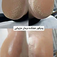 پدیکور و کفسابی پا|خدمات آرایشگری و زیبایی|قم, صدوق|دیوار