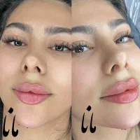 جشنواره ژل لب روسی فیلرزاویه بوتاکس مزو لیزرفیشیال|خدمات آرایشگری و زیبایی|شهریار, شهریار|دیوار