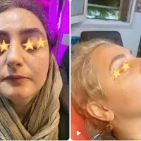 قسطی فیلربادی کانتور۴لیفت کره ای ژل لب هیپدیپ باسن|خدمات زیبایی و سلامت|تهران, صادقیه|دیوار